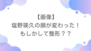 【画像】塩野瑛久の顔が変わった！もしかして整形？？