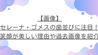 【画像】セレーナ・ゴメスの歯並びに注目！笑顔が美しい理由や過去画像を紹介